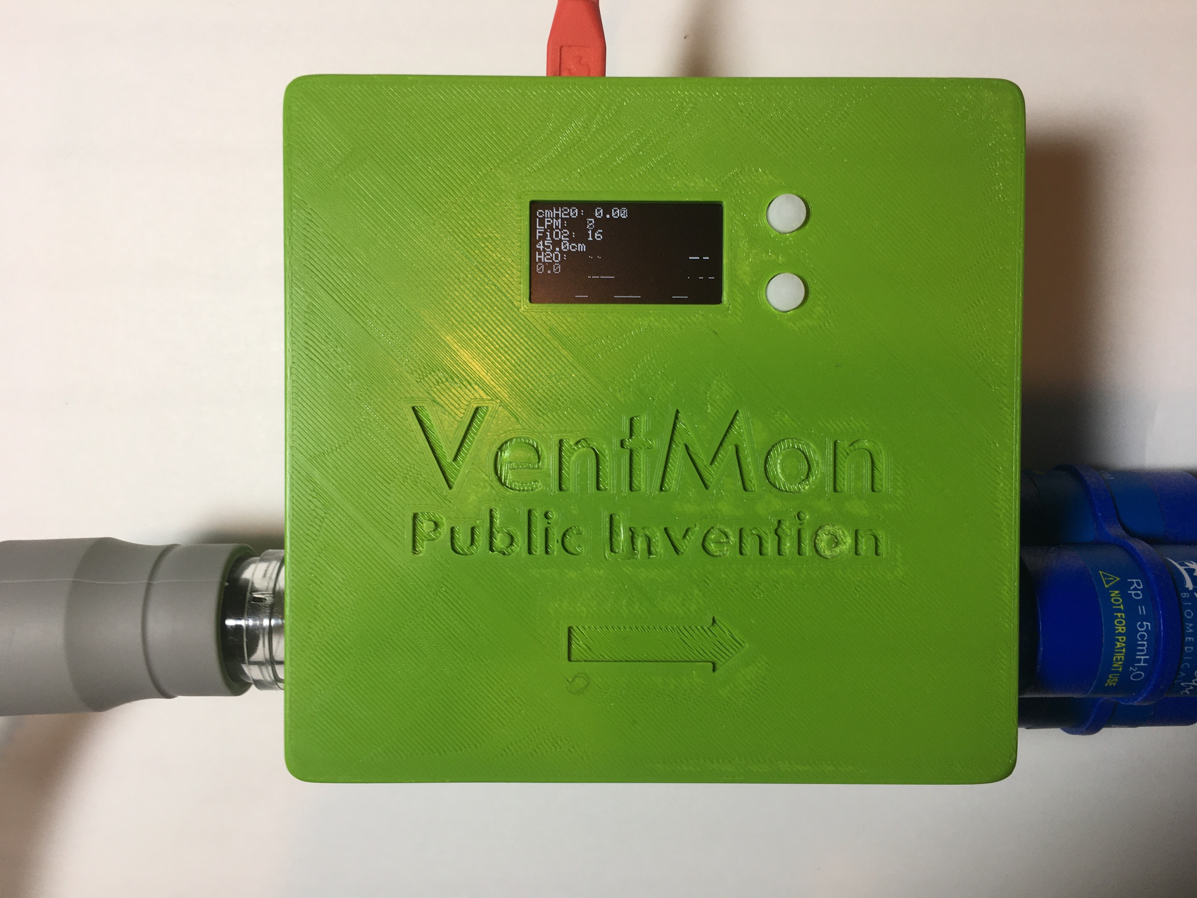 photo of the VentMon equipment